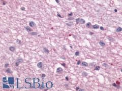 PathPlus™ Polyclonal Rabbit anti-Human MTNR1A / Melatonin Receptor 1a Antibody (Cytoplasmic Domain, IHC)