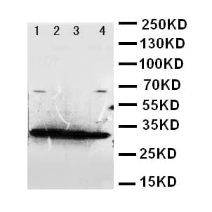 Polyclonal Rabbit anti-Human GDNF Antibody (aa142-158, IHC, WB)