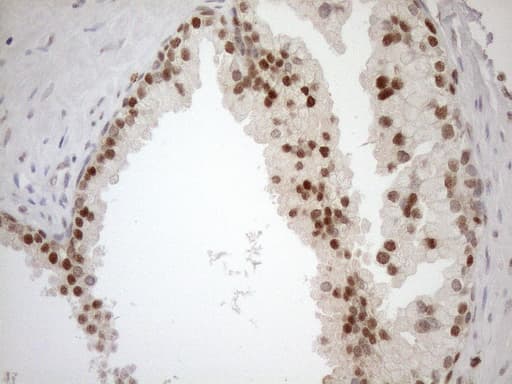 MGMT Antibody (clone OTI2E2)