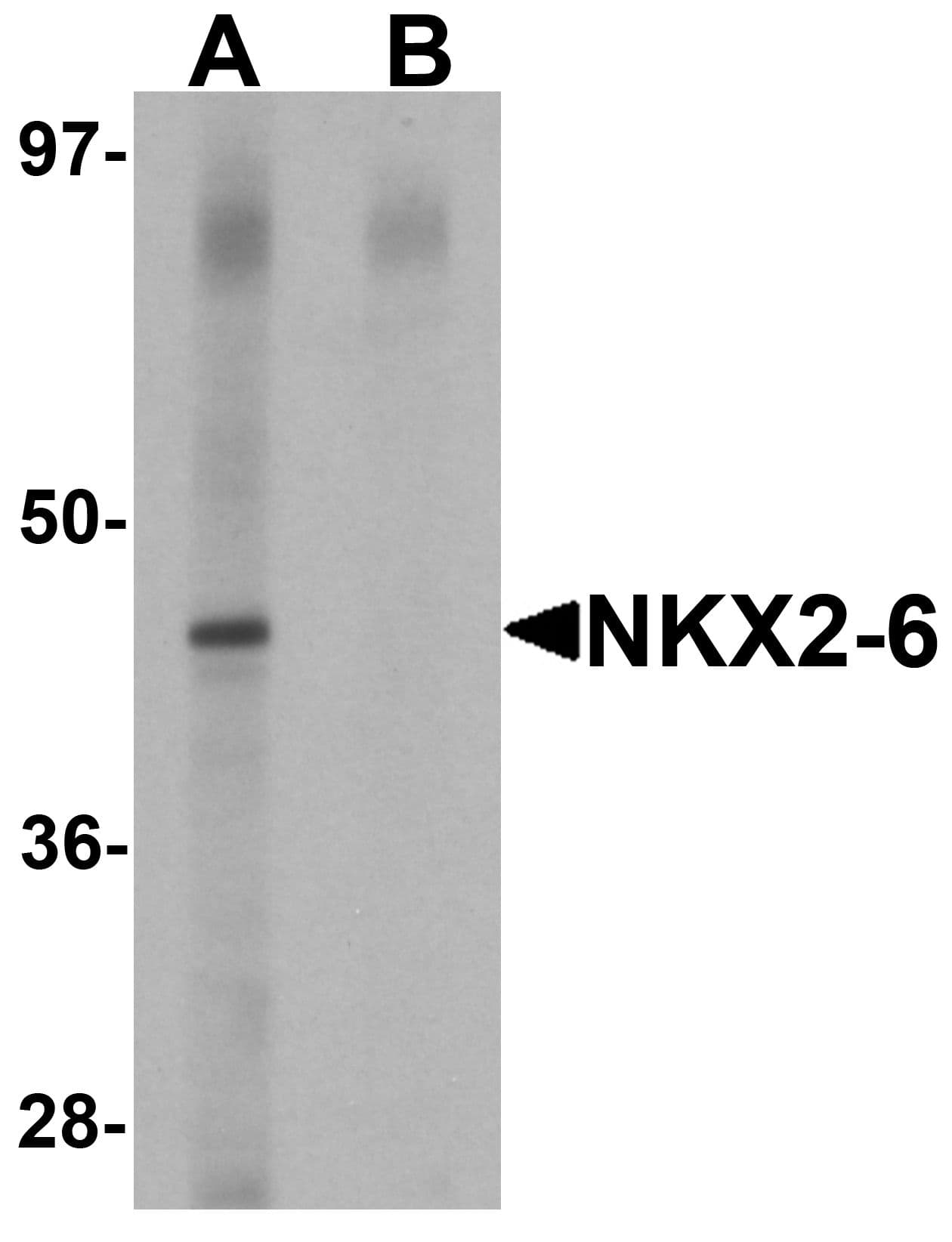 IHC-plus™ NKX2-6 Antibody