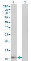 I-BABP / FABP6 Antibody (clone 4A4)