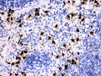S100A8 / MRP8 Antibody