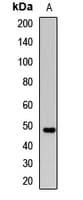 PathPlus™ Polyclonal Rabbit anti-Human ACPP / PAP Antibody (IHC, WB)