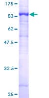 Human ZDHHC17 Protein (Recombinant GST)
