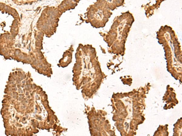 ZBTB43 Antibody