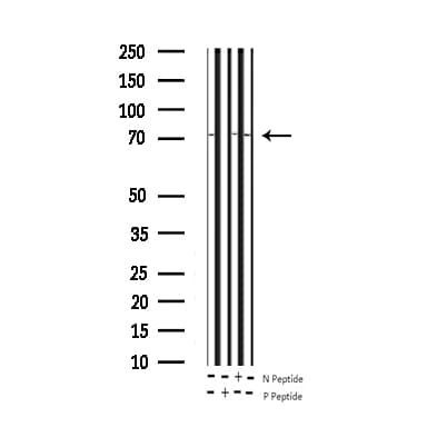 MAPT / Tau Antibody (phospho-Ser356)