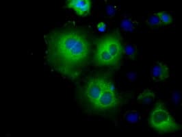 HK2 / Hexokinase 2 Antibody (clone OTI4C5)