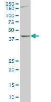Monoclonal Mouse anti-Human DLX2 Antibody (clone 2H2, IHC, WB)