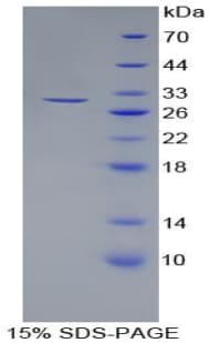 Rat LAMB3 / Laminin Beta 3 Protein (Recombinant His-T7)