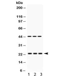 Polyclonal Rabbit anti-Human RAB13 Antibody (IHC, WB)