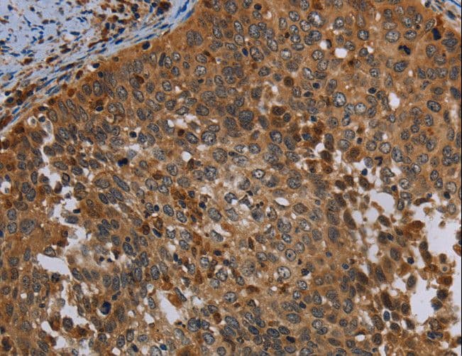 OSM / Oncostatin M Antibody