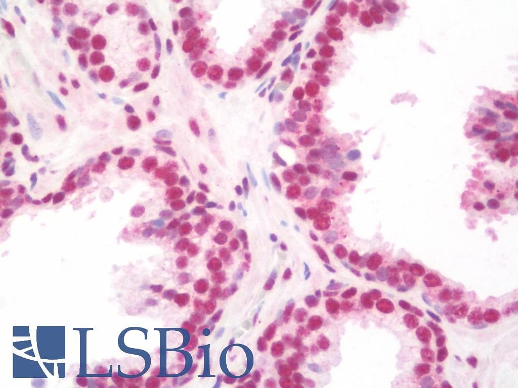 IHC-plus™ NELFA / WHSC2 Antibody (aa280-511, clone 6B11H8)