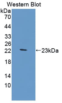 A1BG Antibody (aa27-204, PE)