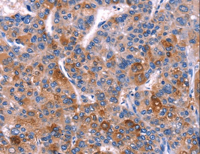 DUSP13 Antibody