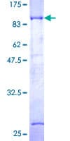 Human DTNB / Dystrobrevin Beta Protein (Recombinant GST)