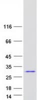 Human ZNF323 Protein (Recombinant Myc-DDK (Flag))