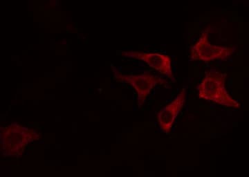 Polyclonal Rabbit anti-Human AGPAT4 Antibody (IF, WB)