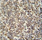 DENND1B Antibody (aa39-68)