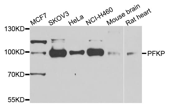 PFKP Antibody