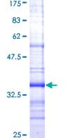 Human NPY1R Protein (Recombinant GST, N-terminus)
