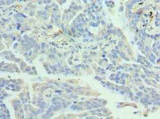 Polyclonal Rabbit anti-Human EZH1 / ENX-2 Antibody (aa160-280, IHC, WB)