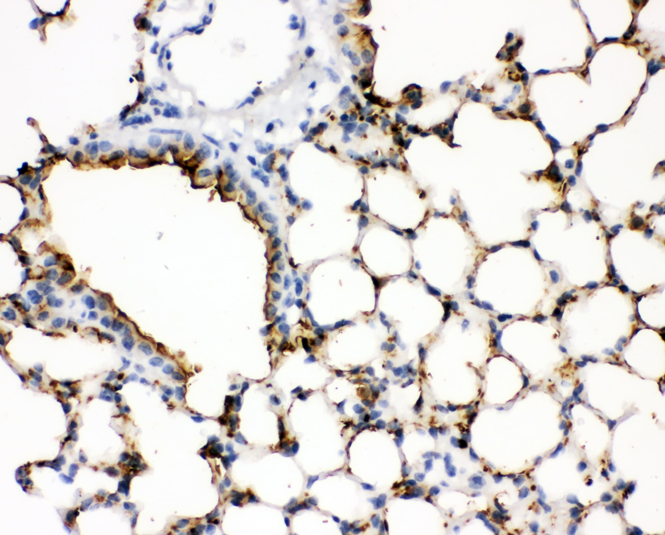SFTPA1 / Surfactant Protein A Antibody (aa233-248)