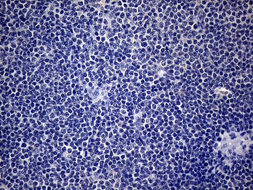 SP110 Antibody (aa232-521, clone OTI1H5)