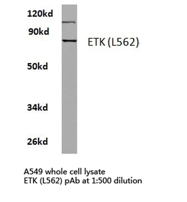 Polyclonal Rabbit anti-Human ETK / BMX Antibody (Leu562, IHC, IF, WB)