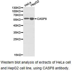 CCM2 / Malcavernin Antibody