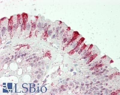 IHC-plus™ FAM53C Antibody (aa342-392)