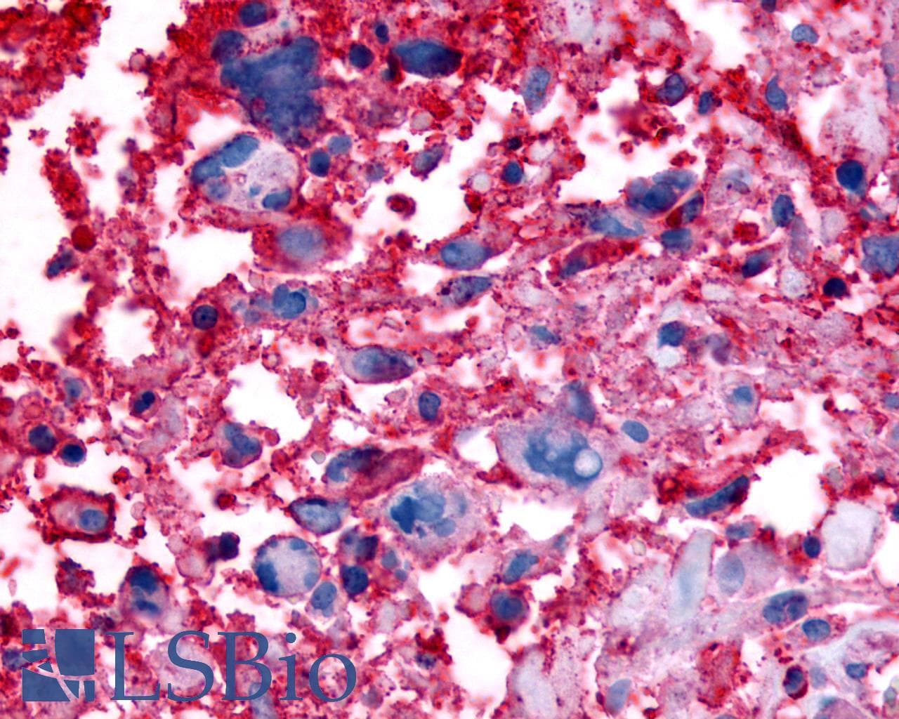 IHC-plus™ Polyclonal Rabbit anti-Human GPR63 Antibody (Cytoplasmic Domain, IHC)