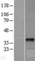 DOK5 Protein (Over-Expression Lysate Myc-DDK (Flag))