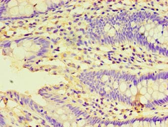 Polyclonal Rabbit anti-Human HSPBAP1 Antibody (aa1-488, IHC)