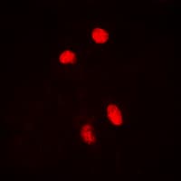 HSF1 Antibody (phospho-Ser303)
