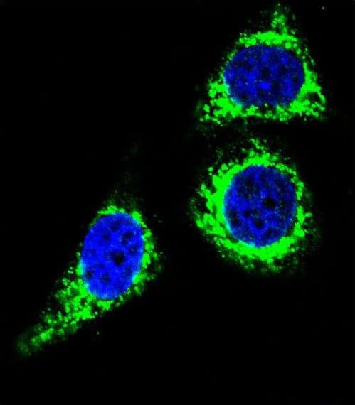 BCL10 / BCL-10 Antibody (aa24-51)