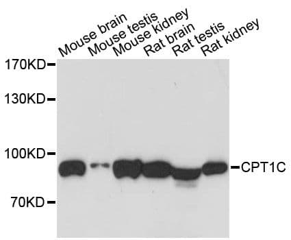 CPT1C Antibody