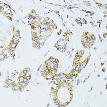 Polyclonal Rabbit anti-Human EGFR Antibody (IHC, IF, WB)