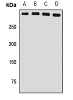 Polyclonal Rabbit anti-Human USP24 Antibody (WB)