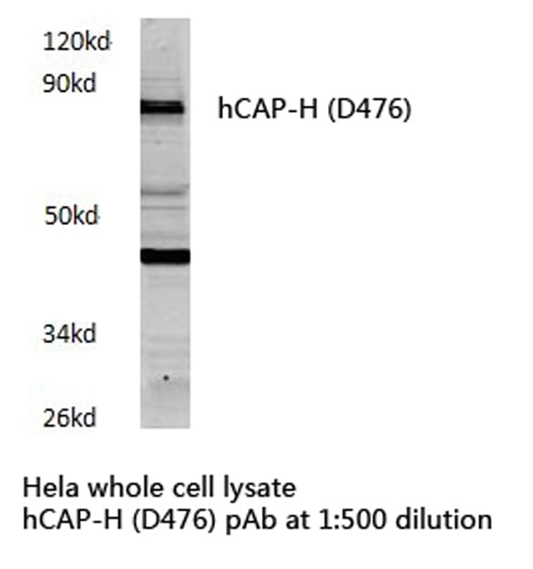 NCAPH / CAP-H Antibody (Asp476)