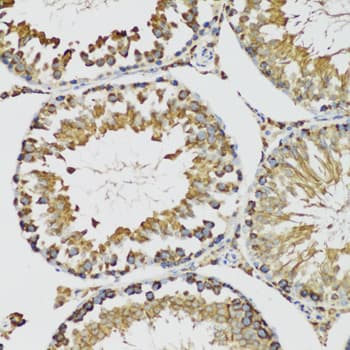 Polyclonal Rabbit anti-Human HSPA9 / Mortalin / GRP75 Antibody (IHC, IF, WB)