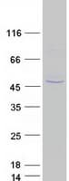 Human PIH1D2 Protein (Recombinant Myc-DDK (Flag))