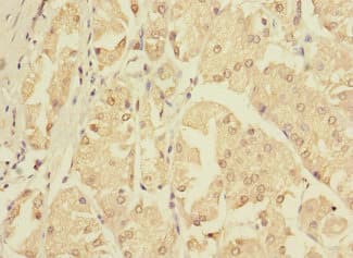 ZNF624 Antibody