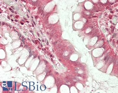 IHC-plus™ SLC3A1 / ATR1 Antibody (aa156-184)