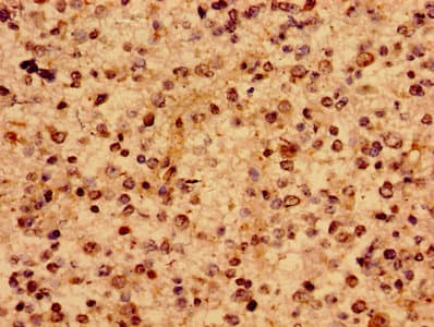 RAB10 Antibody