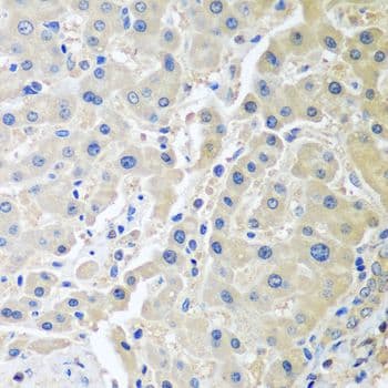 LRP6 Antibody