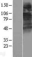 CTNS / Cystinosin Protein (Over-Expression Lysate Myc-DDK (Flag))