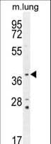 TWF2 / PTK9L Antibody (aa28-57)