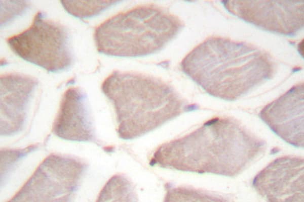 DDIT3 / CHOP Antibody (Gln26)