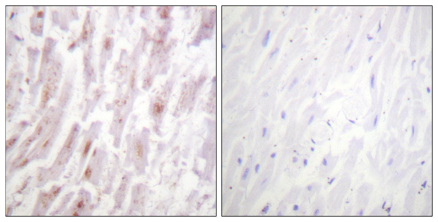 CRYAB / Alpha B Crystallin Antibody