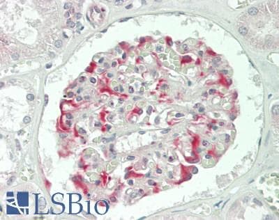 XCL1 / Lymphotactin Antibody (aa27-107)